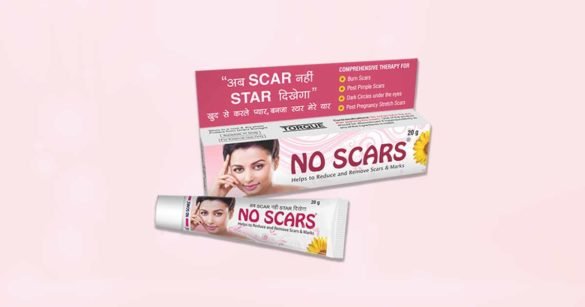 scars or acne scars