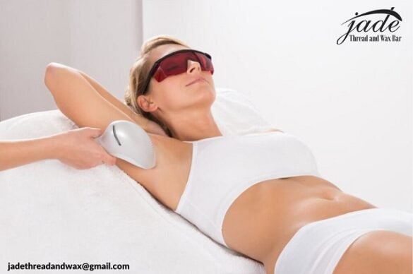 laser hair removal